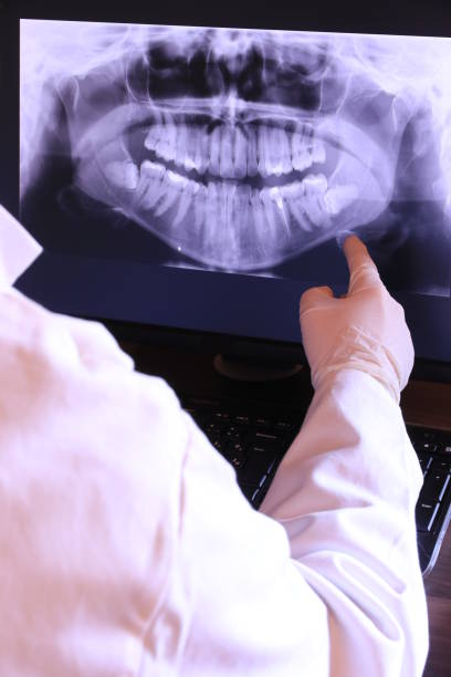 Best Emergency Dentist for Knocked-Out Tooth in Sheffield, AL