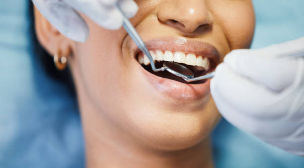 Best Emergency Dental Care for Abscessed Tooth in Sheffield, AL